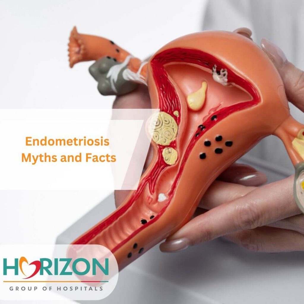 Endometriosis in Thane