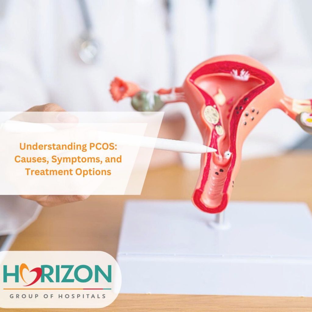 PCOS Treatment in Thane