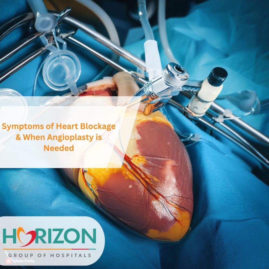 Angioplasty cost in Thane