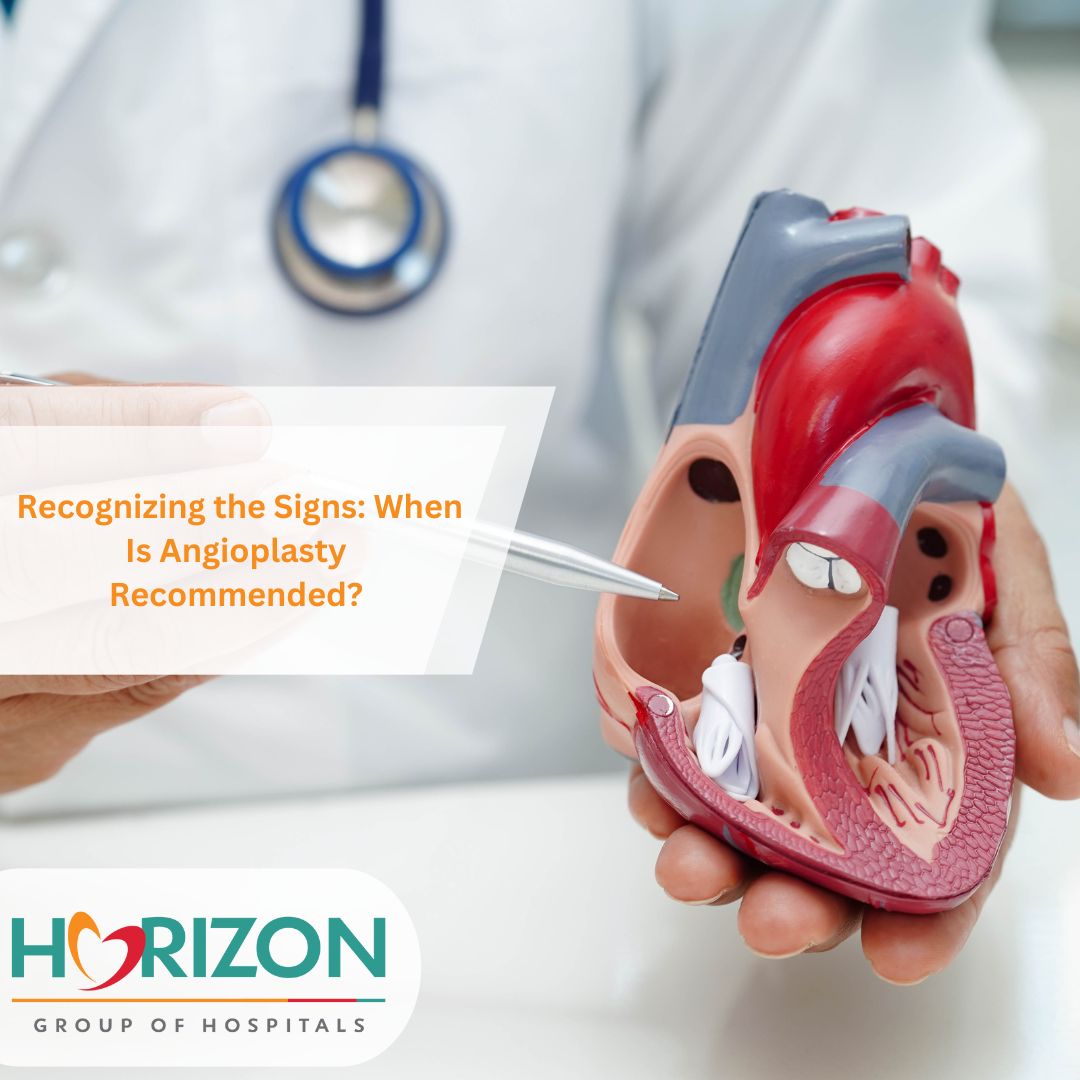 Angioplasty in Thane