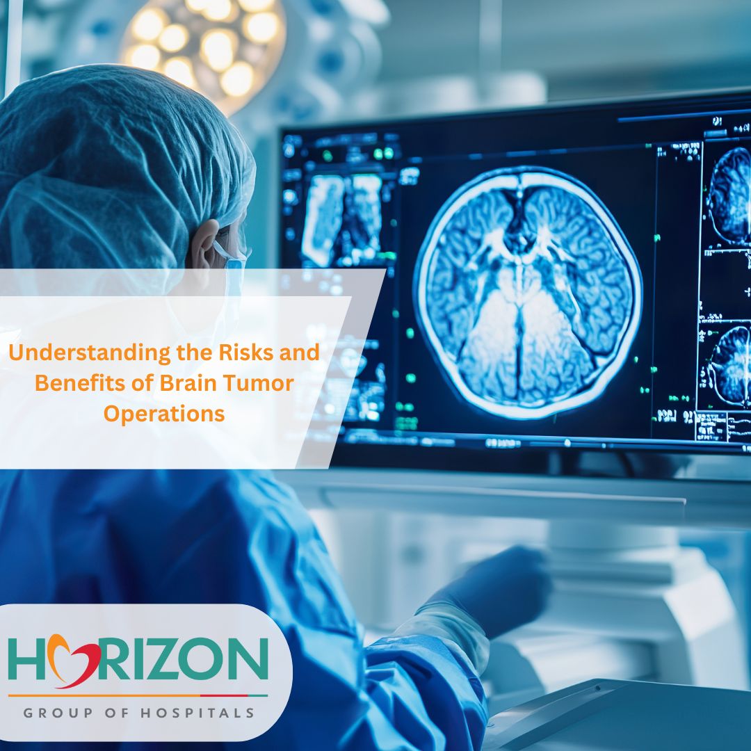 Brain Tumor Operation in Thane