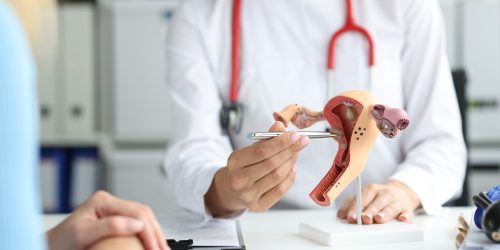Fibroid Removal Surgery in Thane Fibroid Removal Surgery in Thane