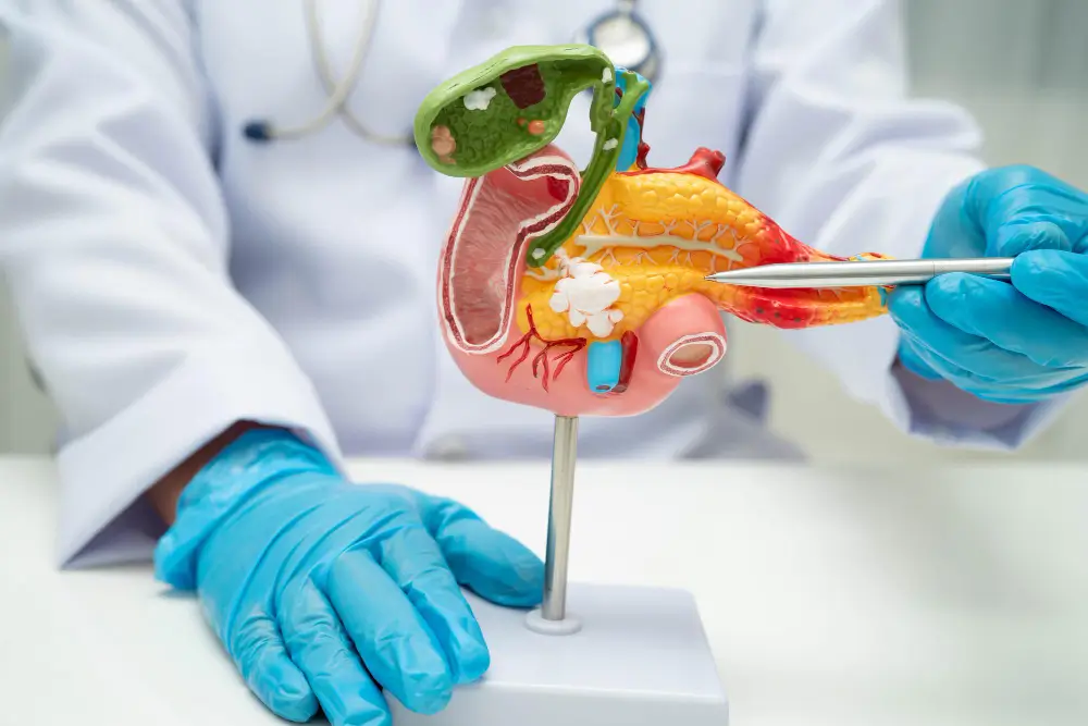 Gallstone Surgery in Thane Gallstone Surgery in Thane