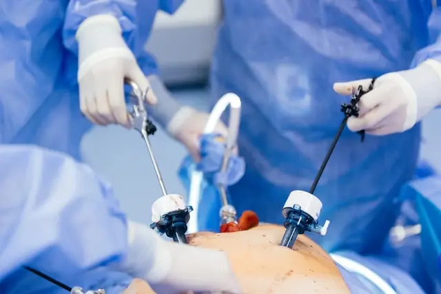 Laparoscopic Appendectomy in Thane Laparoscopic Appendectomy in Thane