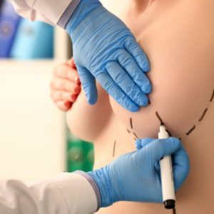 Breast Surgery
