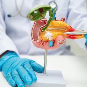 Gallstone Surgery