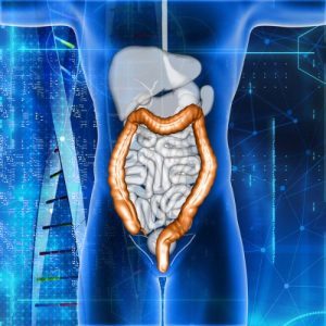 Intestinal Obstruction Surgery