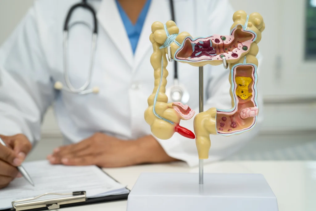 Colonoscopy myths and facts