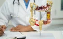 Colonoscopy myths and facts