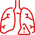 Pleural Effusion