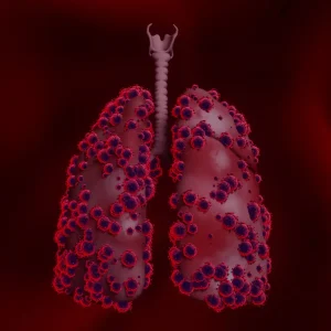 Pleurodesis in Thane