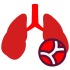 Pulmonary Hypertension