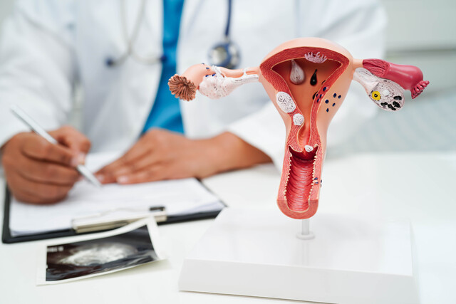 Can Endometriosis Cause Cancer?