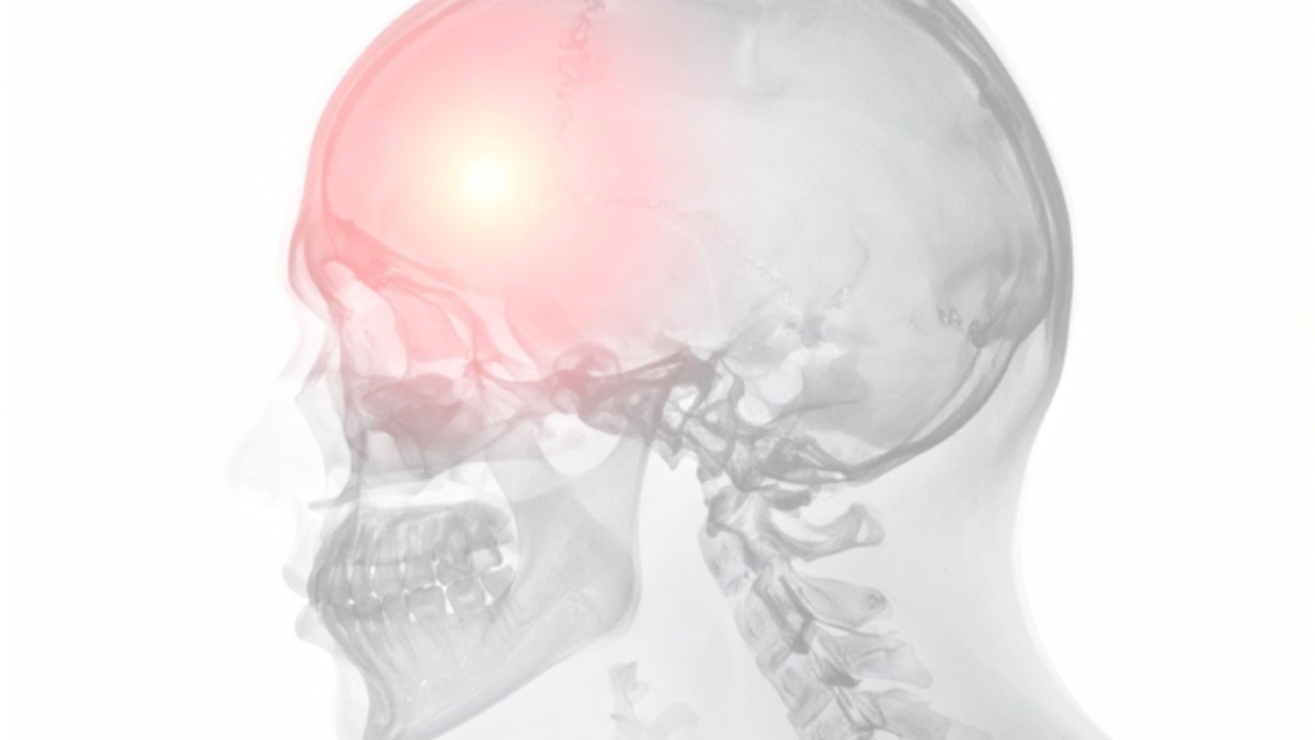 One Month Before Stroke Warning Signs