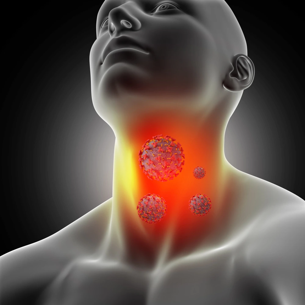 Throat Cancer