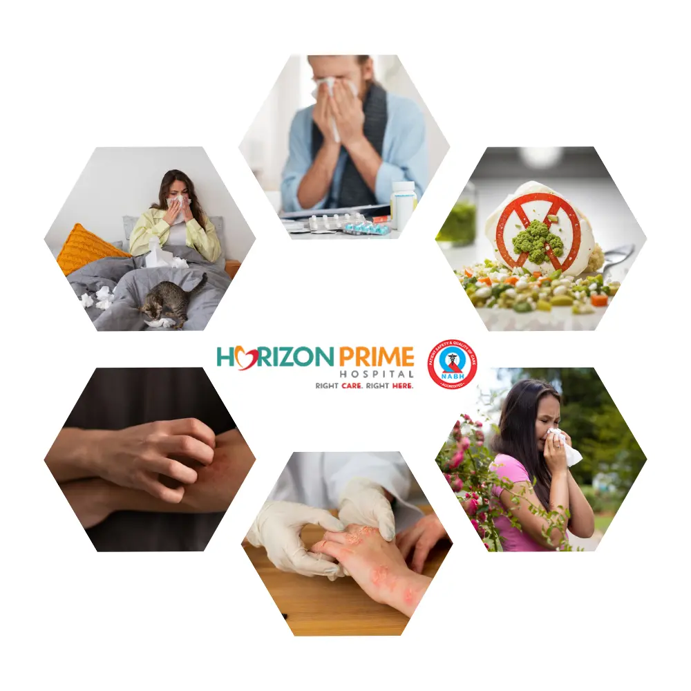 Allergy Treatment Allergy Treatment in Thane