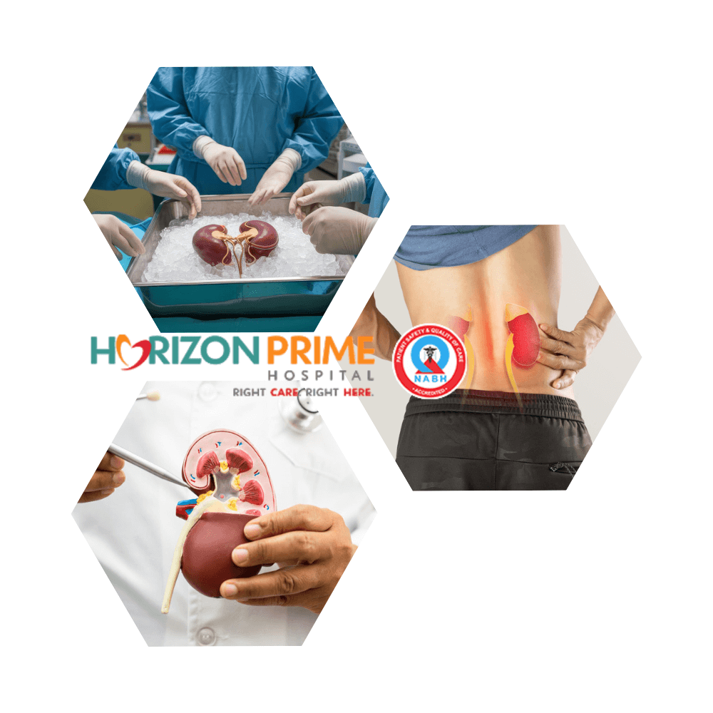 Kidney Transplant Kidney Transplant in Thane