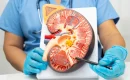 Advantages of Kidney Transplant