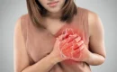 Heart Problem Symptoms in Females