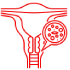 Cervical Cancer New Cervical Cancer New